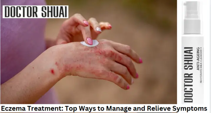 Eczema Treatment: Top Ways to Manage and Relieve Symptoms